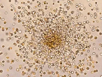 hematopoitic