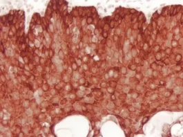 ImmPACT® NovaRED® Substrate, Peroxidase (HRP)