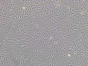 mesenchymal