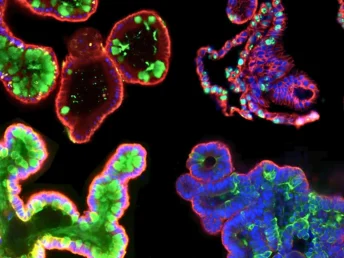 organoid