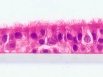 pulmonary