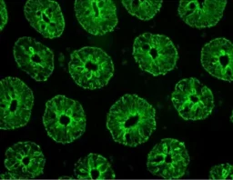 vectafluor-excel-amplified-anti-rabbit-igg-dylight-488-antibody-kit