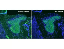 Vector TrueVIEW Autofluorescence Quenching Kit with DAPI